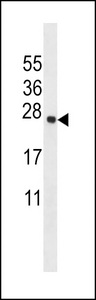 TMEM18 Antibody - TMM18 Antibody western blot of mouse testis tissue lysates (35 ug/lane). The TMM18 antibody detected the TMM18 protein (arrow).