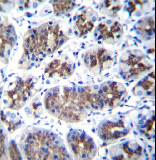 TMEM18 Antibody - TMM18 Antibody immunohistochemistry of formalin-fixed and paraffin-embedded human stomach tissue followed by peroxidase-conjugated secondary antibody and DAB staining.