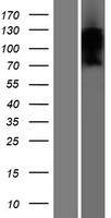 TMEM180 Protein - Western validation with an anti-DDK antibody * L: Control HEK293 lysate R: Over-expression lysate