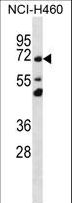 TMEM181 Antibody - TM181 Antibody western blot of NCI-H460 cell line lysates (35 ug/lane). The TM181 antibody detected the TM181 protein (arrow).