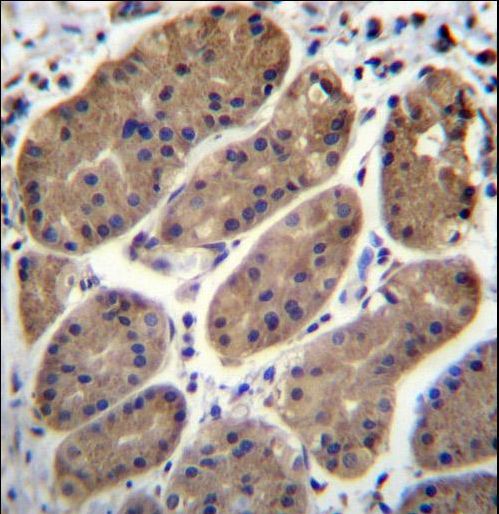 TMEM181 Antibody - TM181 Antibody immunohistochemistry of formalin-fixed and paraffin-embedded human stomach tissue followed by peroxidase-conjugated secondary antibody and DAB staining.