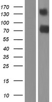 TMEM181 Protein - Western validation with an anti-DDK antibody * L: Control HEK293 lysate R: Over-expression lysate
