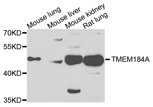 TMEM184A Antibody - Western blot analysis of extracts of various cells.