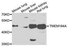 TMEM184A Antibody - Western blot analysis of extracts of various cells.