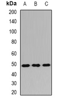 TMEM184A Antibody - Western blot analysis of TMEM184A expression in mouse liver (A); mouse kidney (B); rat lung (C) whole cell lysates.