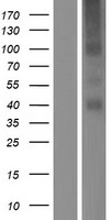 TMEM184A Protein - Western validation with an anti-DDK antibody * L: Control HEK293 lysate R: Over-expression lysate