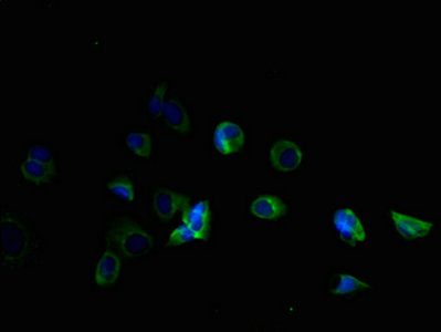 TMEM184B Antibody - Immunofluorescent analysis of MCF-7 cells using TMEM184B Antibody at dilution of 1:100 and Alexa Fluor 488-congugated AffiniPure Goat Anti-Rabbit IgG(H+L)