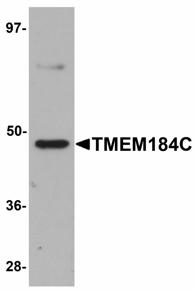 TMEM184C Antibody - Western blot of TMEM184C in mouse heart tissue lysate with TMEM184C antibody at 1 ug/ml.