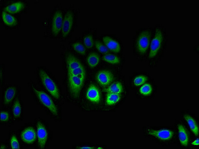 TMEM184C Antibody - Immunofluorescent analysis of HepG2 cells using TMEM184C Antibody at dilution of 1:100 and Alexa Fluor 488-congugated AffiniPure Goat Anti-Rabbit IgG(H+L)