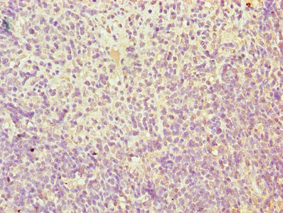 TMEM184C Antibody - Immunohistochemistry of paraffin-embedded human thymus tissue using TMEM184C Antibody at dilution of 1:100