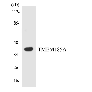 TMEM185A / FAM11A Antibody - Western blot analysis of the lysates from HT-29 cells using TMEM185A antibody.