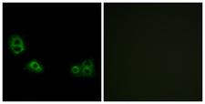 TMEM185A / FAM11A Antibody - Immunofluorescence analysis of MCF7 cells, using TMEM185A Antibody. The picture on the right is blocked with the synthesized peptide.