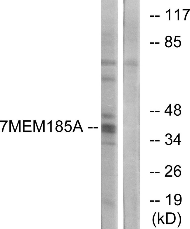 TMEM185A / FAM11A Antibody - Western blot analysis of lysates from K562 cells, using TMEM185A Antibody. The lane on the right is blocked with the synthesized peptide.
