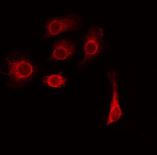 TMEM185A / FAM11A Antibody - Staining HeLa cells by IF/ICC. The samples were fixed with PFA and permeabilized in 0.1% Triton X-100, then blocked in 10% serum for 45 min at 25°C. The primary antibody was diluted at 1:200 and incubated with the sample for 1 hour at 37°C. An Alexa Fluor 594 conjugated goat anti-rabbit IgG (H+L) Ab, diluted at 1/600, was used as the secondary antibody.