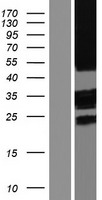 TMEM185A / FAM11A Protein - Western validation with an anti-DDK antibody * L: Control HEK293 lysate R: Over-expression lysate