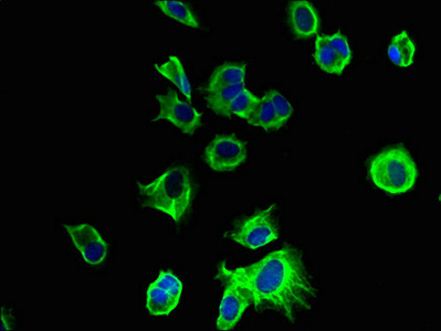 TMEM186 Antibody - Immunofluorescent analysis of MCF-7 cells using TMEM186 Antibody at dilution of 1:100 and Alexa Fluor 488-congugated AffiniPure Goat Anti-Rabbit IgG(H+L)