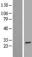 TMEM186 Protein - Western validation with an anti-DDK antibody * L: Control HEK293 lysate R: Over-expression lysate