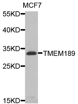 TMEM189 Antibody - Western blot analysis of extracts of MCF7 cells.