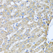 TMEM189 Antibody - Immunohistochemistry of paraffin-embedded human liver tissue.