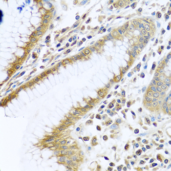TMEM189 Antibody - Immunohistochemistry of paraffin-embedded human stomach tissue.