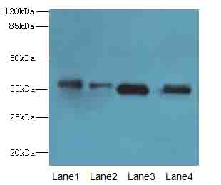 TMEM19 Antibody - Western blot. All lanes: TMEM19 antibody at 1 ug/ml. Lane 1: MCF7 whole cell lysate. Lane 2: U251 whole cell lysate. Lane 3: Mouse stomach tissue. Lane 4: A549 whole cell lysate. Secondary Goat polyclonal to Rabbit IgG at 1:10000 dilution. Predicted band size: 36 kDa. Observed band size: 36 kDa.