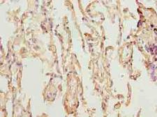 TMEM19 Antibody - Immunohistochemistry of paraffin-embedded human lung tissue using antibody at dilution of 1:100.