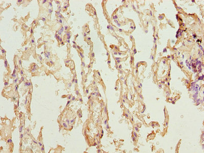 TMEM19 Antibody - Immunohistochemistry of paraffin-embedded human lung tissue using TMEM19 Antibody at dilution of 1:100