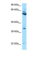 TMEM192 Antibody - TMEM192 antibody Western blot of HCT15 Cell lysate. Antibody concentration 1 ug/ml.  This image was taken for the unconjugated form of this product. Other forms have not been tested.