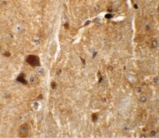 TMEM192 Antibody - Immunohistochemistry of TMEM192 in mouse brain tissue with TMEM192 antibody at 5 ug/ml.