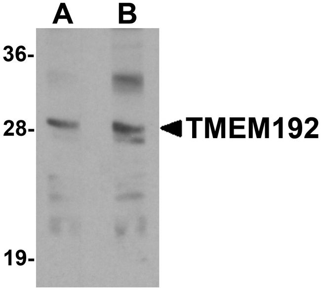 TMEM192 Antibody - Western blot analysis of TMEM192 in SK-N-SH cell lysate with TMEM192 antibody at (A) 0.5 and (B) 1 ug/ml.