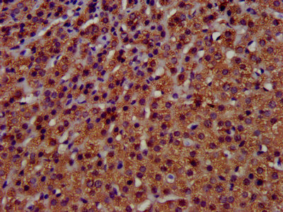 TMEM192 Antibody - IHC image of TMEM192 Antibody diluted at 1:400 and staining in paraffin-embedded human adrenal gland tissue performed on a Leica BondTM system. After dewaxing and hydration, antigen retrieval was mediated by high pressure in a citrate buffer (pH 6.0). Section was blocked with 10% normal goat serum 30min at RT. Then primary antibody (1% BSA) was incubated at 4°C overnight. The primary is detected by a biotinylated secondary antibody and visualized using an HRP conjugated SP system.