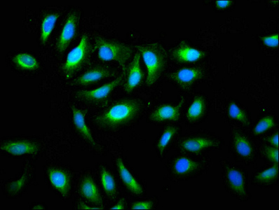 TMEM192 Antibody - Immunofluorescence staining of A549 cells with TMEM192 Antibody at 1:133, counter-stained with DAPI. The cells were fixed in 4% formaldehyde, permeabilized using 0.2% Triton X-100 and blocked in 10% normal Goat Serum. The cells were then incubated with the antibody overnight at 4°C. The secondary antibody was Alexa Fluor 488-congugated AffiniPure Goat Anti-Rabbit IgG(H+L).