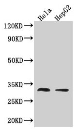 TMEM192 Antibody - Western Blot Positive WB detected in: Hela whole cell lysate, All lanes: TMEM192 antibody at 3.2µg/ml Secondary Goat polyclonal to rabbit IgG at 1/50000 dilution Predicted band size: 31 kDa Observed band size: 31 kDa