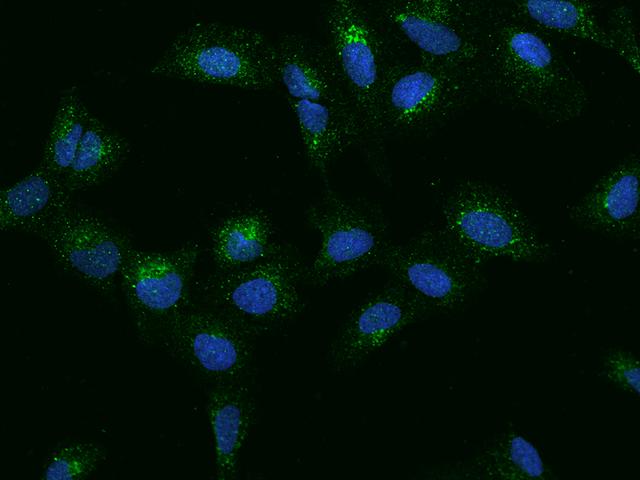 TMEM192 Antibody - Immunofluorescence staining of TMEM192 in U2OS cells. Cells were fixed with 4% PFA, permeabilzed with 0.1% Triton X-100 in PBS, blocked with 10% serum, and incubated with rabbit anti-Human TMEM192 polyclonal antibody (dilution ratio 1:100) at 4°C overnight. Then cells were stained with the Alexa Fluor 488-conjugated Goat Anti-rabbit IgG secondary antibody (green) and counterstained with DAPI (blue). Positive staining was localized to Cytoplasm.