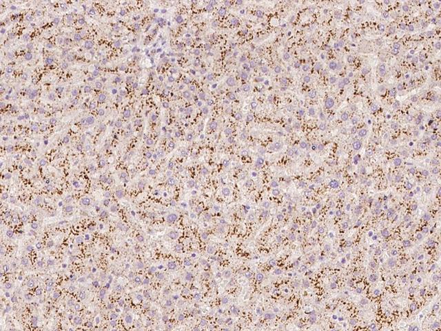 TMEM192 Antibody - Immunochemical staining of human TMEM192 in human liver with rabbit polyclonal antibody at 1:100 dilution, formalin-fixed paraffin embedded sections.