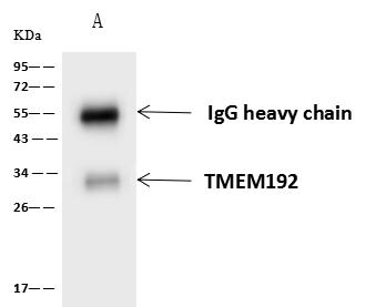 TMEM192 Antibody - TMEM192 was immunoprecipitated using: Lane A: 0.5 mg U251MG Whole Cell Lysate. 4 uL anti-TMEM192 rabbit polyclonal antibody and 60 ug of Immunomagnetic beads Protein A/G. Primary antibody: Anti-TMEM192 rabbit polyclonal antibody, at 1:100 dilution. Secondary antibody: Goat Anti-Rabbit IgG (H+L)/HRP at 1/10000 dilution. Developed using the ECL technique. Performed under reducing conditions. Predicted band size: 31 kDa. Observed band size: 31 kDa.