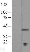 TMEM194A Protein - Western validation with an anti-DDK antibody * L: Control HEK293 lysate R: Over-expression lysate