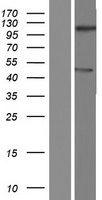 TMEM194B Protein - Western validation with an anti-DDK antibody * L: Control HEK293 lysate R: Over-expression lysate
