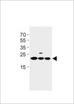 TMEM199 Antibody - TMEM199 Antibody western blot of A549,293,U251 cell line lysates (35 ug/lane). The TMEM199 antibody detected the TMEM199 protein (arrow).