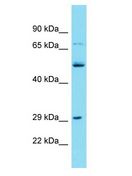 TMEM199 Antibody - TMEM199 antibody Western Blot of Jurkat. Antibody dilution: 1 ug/ml.  This image was taken for the unconjugated form of this product. Other forms have not been tested.