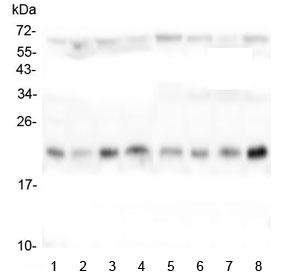 TMEM199 Antibody - Western blot testing of human 1) HeLa, 2) placenta, 3) Caco-2, 4) T-47D, 5) U-87 MG, 6) K562, 7) U-2 OS and 8) PC-3 lysate with TMEM199 antibody at 0.5ug/ml. Predicted molecular weight ~23 kDa.