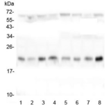TMEM199 Antibody - Western blot testing of human 1) HeLa, 2) placenta, 3) Caco-2, 4) T-47D, 5) U-87 MG, 6) K562, 7) U-2 OS and 8) PC-3 lysate with TMEM199 antibody at 0.5ug/ml. Predicted molecular weight ~23 kDa.