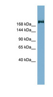 TMEM2 Antibody - TMEM2 antibody Western blot of PANC1 cell lysate. This image was taken for the unconjugated form of this product. Other forms have not been tested.
