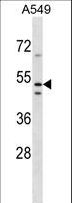 TMEM200A Antibody - TMEM200A Antibody western blot of A549 cell line lysates (35 ug/lane). The TMEM200A antibody detected the TMEM200A protein (arrow).