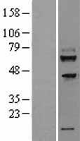 TMEM200A Protein - Western validation with an anti-DDK antibody * L: Control HEK293 lysate R: Over-expression lysate