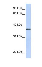TMEM200B / TTMB Antibody - Placenta lysate. Antibody concentration: 1.0 ug/ml. Gel concentration: 12%.  This image was taken for the unconjugated form of this product. Other forms have not been tested.