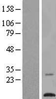 TMEM203 Protein - Western validation with an anti-DDK antibody * L: Control HEK293 lysate R: Over-expression lysate