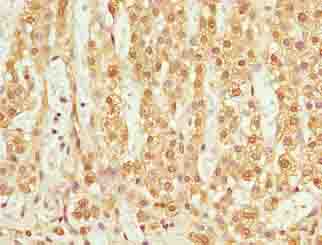 TMEM205 Antibody - Immunohistochemistry of paraffin-embedded human adrenal gland tissue using antibody at dilution of 1:100.