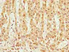 TMEM205 Antibody - Immunohistochemistry of paraffin-embedded human adrenal gland tissue using antibody at dilution of 1:100.