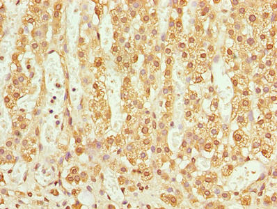 TMEM205 Antibody - Immunohistochemistry of paraffin-embedded human adrenal gland tissue using TMEM205 Antibody at dilution of 1:100